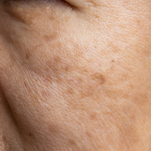 Close-up of human skin texture