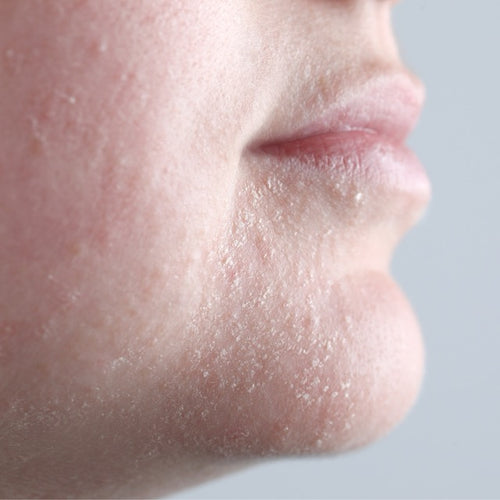 Close-up of a person's chin and lower face with visible skin texture.