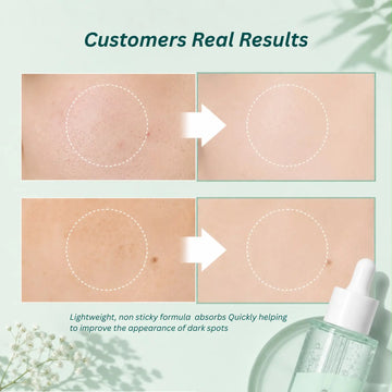 Yuri Woori Niacinamide All-In One Brightening Ampoule